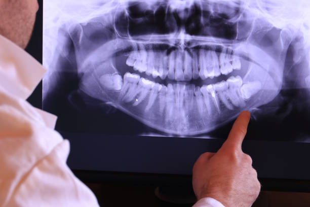 Best Emergency Root Canal Treatment in Atlantic Beach, NC