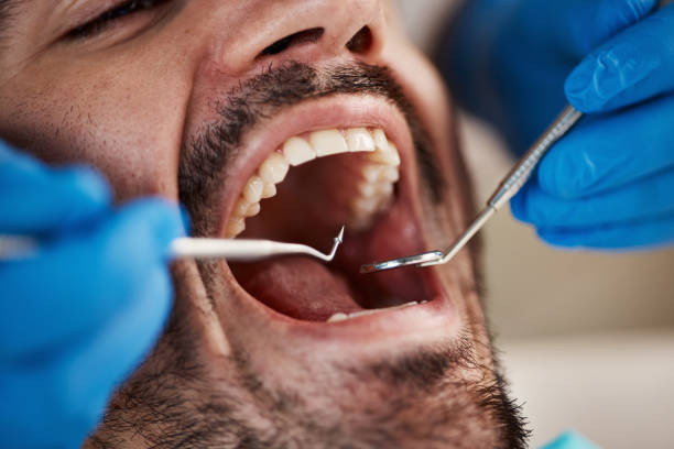Best Emergency Gum Treatment in Atlantic Beach, NC